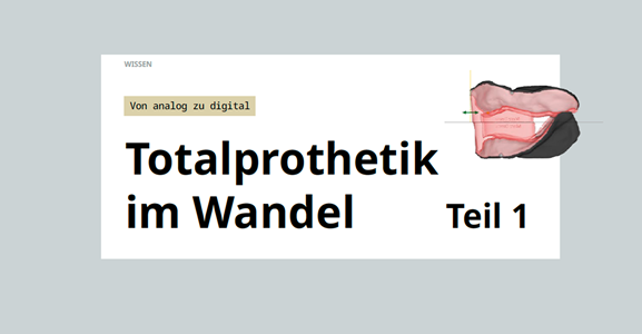 Titelbild: Totalprothetik im Wandel Teil 1