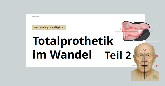 Titelbild: Totalprothetik im Wandel Teil 2