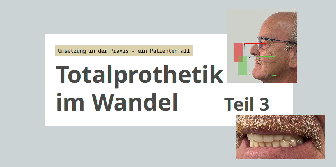 Titelbild: Totalprothetik im Wandel Teil 3